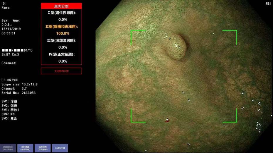 AI攜手創(chuàng)新 海信醫(yī)療與天津御錦共拓醫(yī)療器械新領域